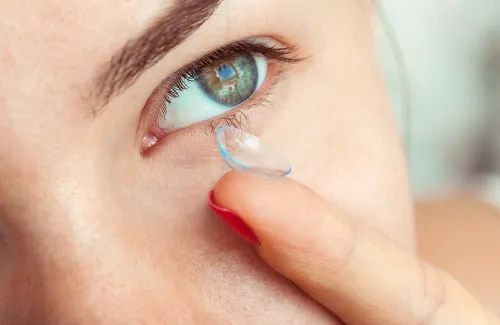 How to Treat Eye Infections from Contact Lenses: Prevention & Quick Care Tips