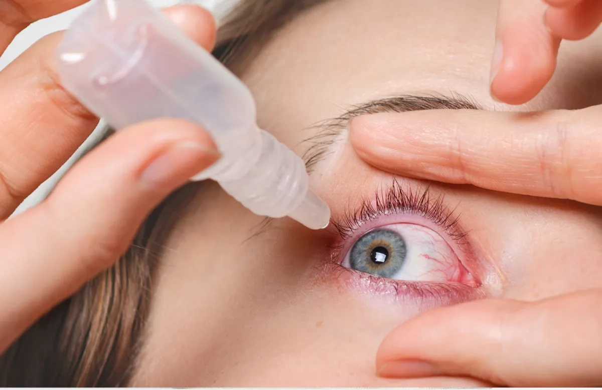 Allergic Conjunctivitis vs. Bacterial Conjunctivitis: How to Tell the Difference