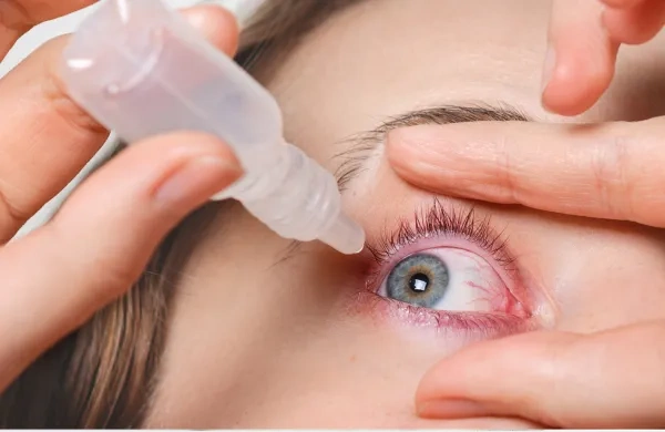 Allergic Conjunctivitis vs. Bacterial Conjunctivitis: How to Tell the Difference